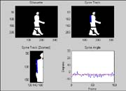 Examples of spine tracking interface layout that is shown to research participants.